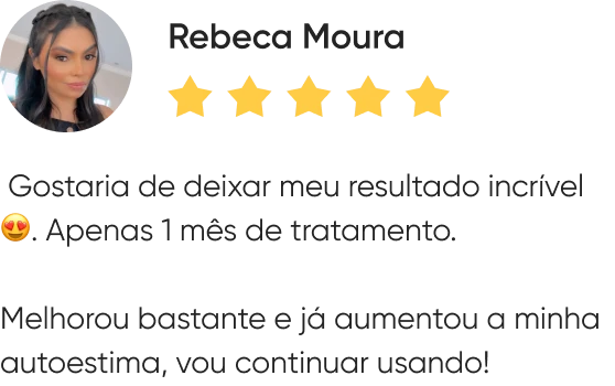reb.webp